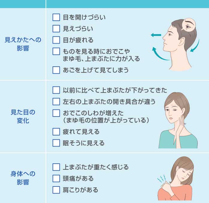 眼瞼下垂症状