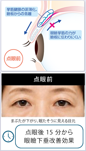 使い方と効果