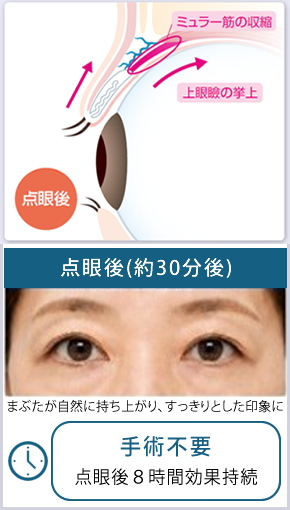 使い方と効果